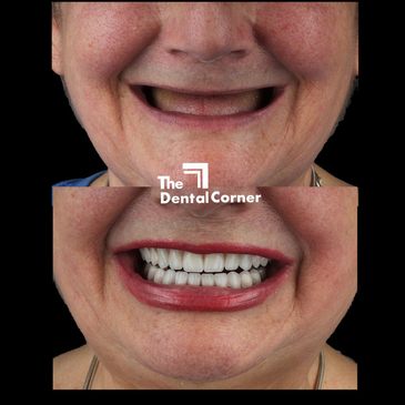 Slider image (8) The Dental Corner